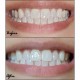 Set 5x Plicuri, Benzi Albirea Dintilor, Crest 3D Whitestrips, Noticeably White, 8% Concentratie Set 5x Plicuri, Benzi Albirea Dintilor, Crest 3D Whitestrips, Noticeably White, 8% Concentratie