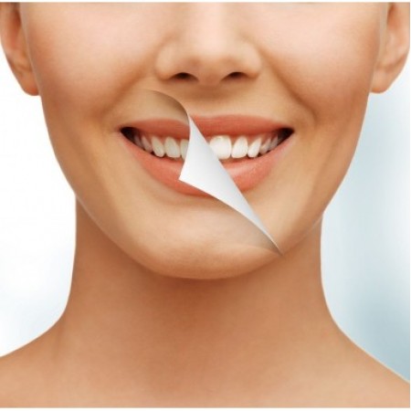 Kit Albirea Dintilor Acasa - 4 Seringi Opalescence 16% + Cutie Gutiera