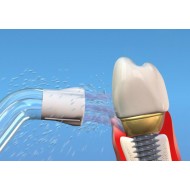 Dus Bucal Waterpik Ultra Dus Bucal Waterpik Ultra