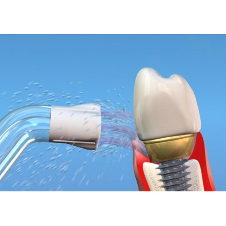 Dus Bucal Waterpik Ultra