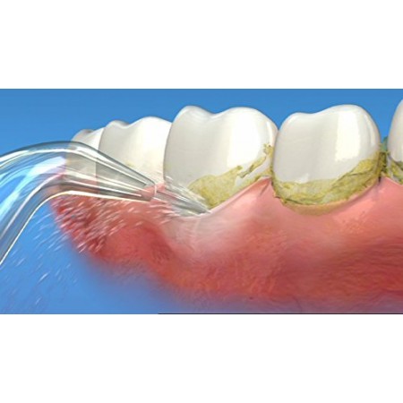 Dus Bucal Waterpik Portabil WP-462 Black 